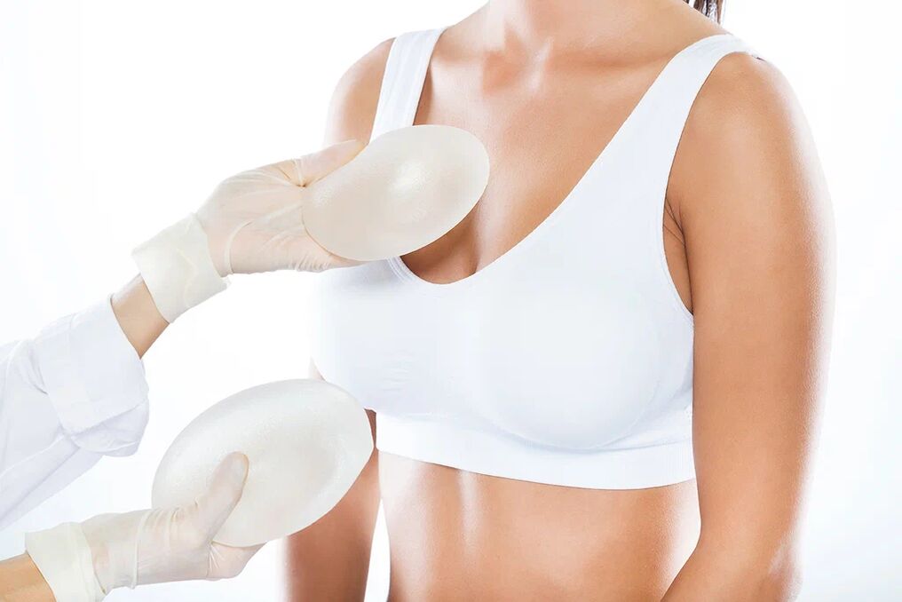 Implantų parinkimas prieš krūtų didinimo operaciją