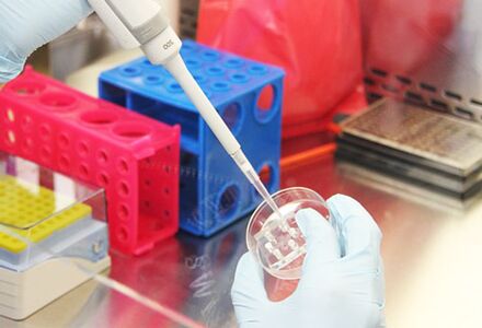 Paciento tyrimų ištyrimas prieš atliekant augmentacinę mammoplastiką